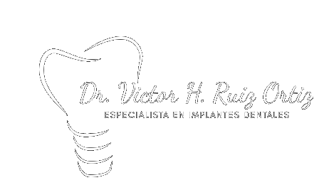 Implantes Dentales Zacatecas – Teúl González Ortega